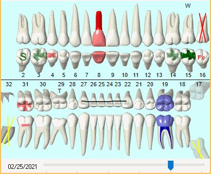 Open Dental Software - Graphical Tooth Chart