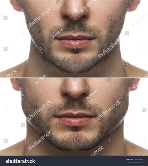 Asymmetric Jaw Over 37 Royalty Free Licensable Stock Photos Shutterstock