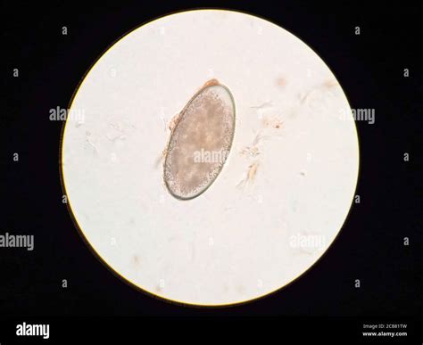 Ear Microscope Hi Res Stock Photography And Images Alamy