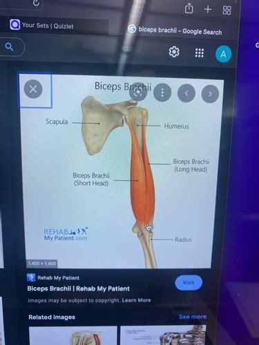 Arm Flashcards Quizlet