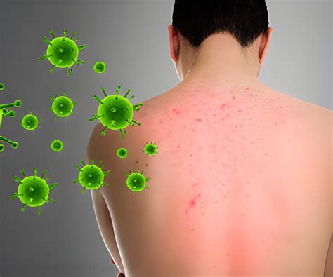 Itchy Skin New Study Reveals Why You Shouldnt Scratch An Itchy Rash
