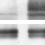 Src Kinase Activity Modulates Fas Induced Apoptosis And Caspase