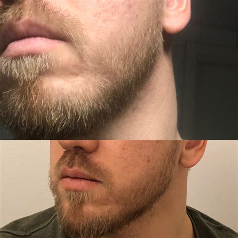 Question About Blonde Beard 7 8 Weeks In 31 Year Old Im Blonde So My Beard Is Quite Light In