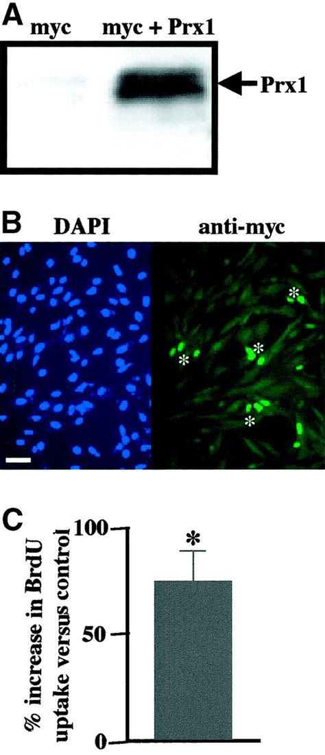 Prx Controls Vascular Smooth Muscle Cell Proliferation And Tenascin C