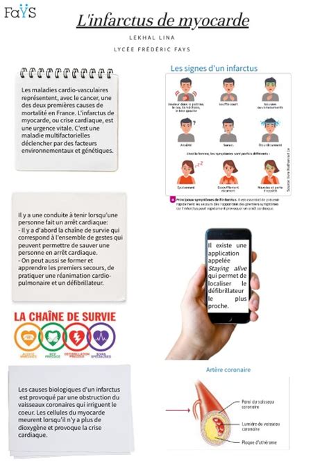 L Infarctus Du Myocarde
