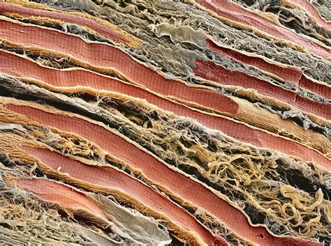 Skeletal Muscle Fibres SEM Stock Image P154 0224 Science Photo