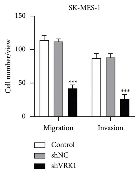 (a, b) Transwell assay to detect cell migration and invasion ability of... | Download Scientific ...