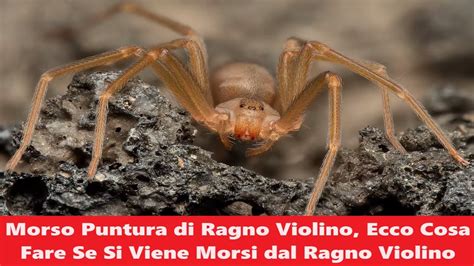 Morso Puntura Di Ragno Violino Ecco Cosa Fare Se Si Viene Morsi Dal