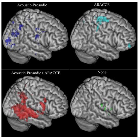 Brain Sciences Free Full Text Explicit Training To Improve