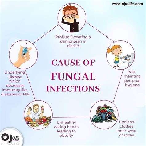 Fungal Infection Goi Sioux Eachelle