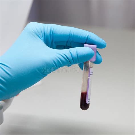 Blood in test tube stock photo. Image of plasma, blood - 28852672