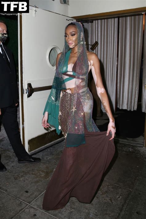 Winnie Harlow Nude The Fappening Photo Fappeningbook