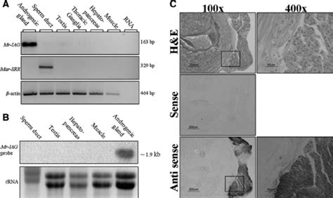 Mr IAG Tissue Specific Expression In Mature M Rosenbergii Males A
