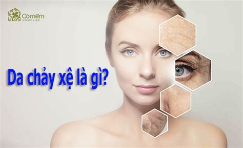 da chay xe la gi nguyen nhan va cach cham soc giup phuc hoi lan da