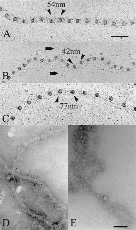 Electron Microscopic Images Of Collagenase Digested Microfibrils A And