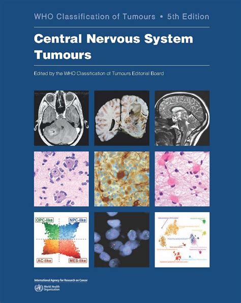 Who Classification Of Tumours Central Nervous Sys