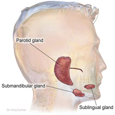 Salivary Gland Stone Sialolithiasis Treatment – Dr. Anuj Kumar