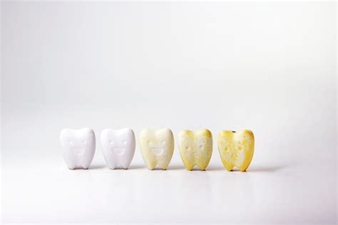 Understanding Tooth Discoloration Causes And Treatment Options Triangle Dentistry