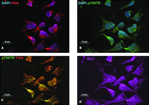 Expression Of Nerve Growth Factor Ngf Receptors In Imhu Cell Lines