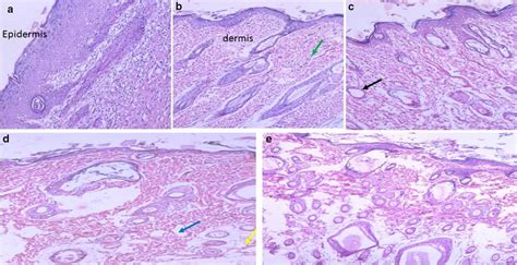 Histological Evaluation Of Skin Wound Healing At Day 14 Download