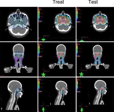 Frontiers Is A High Risk Clinical Target Volume Required Evaluation