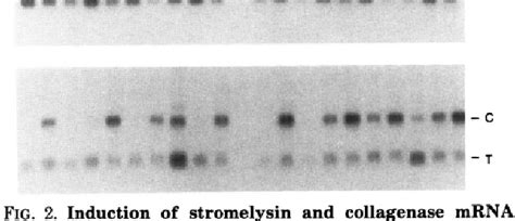 Figure From Discoordinate Expression Of Stromelysin Collagenase And