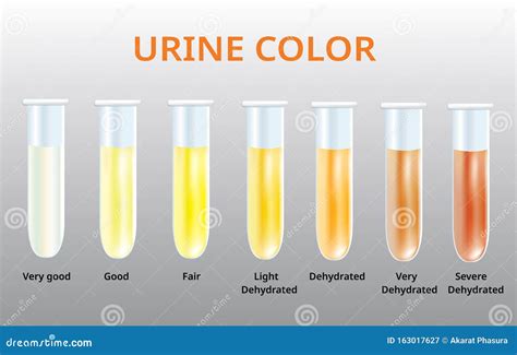 Gráfico De Cores Da Urina Urina Em Tubos De Ensaio Vetor Médico