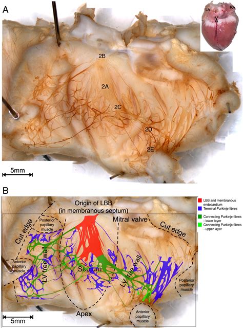 Anatomical And Molecular Mapping Of The Left And Right Ventricular His