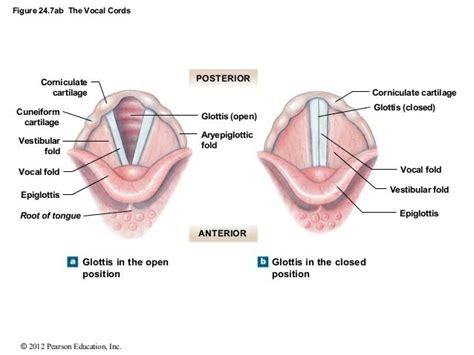 Let's talk Epiglottis — Beth Roars