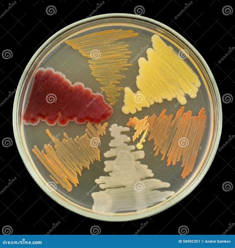 Bacterial Cultures Growth On Petri Plate Dish Isolated On Black Stock