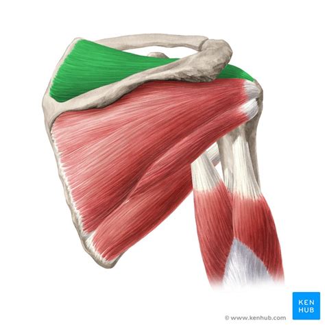 Supraspinatus Tear - Physiopedia