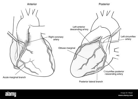 Rama Circunfleja De La Arteria Coronaria Fotograf As E Im Genes De Alta