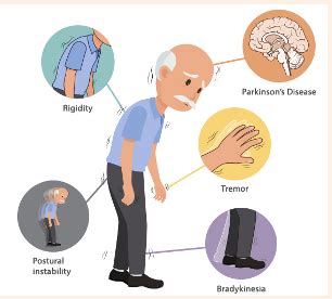 Parkinson S Disease Flashcards Quizlet