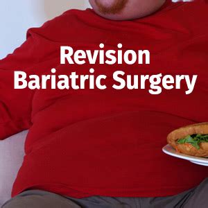 Revision Bariatric Surgery With SmartShape SmartShape Weight Loss Centre