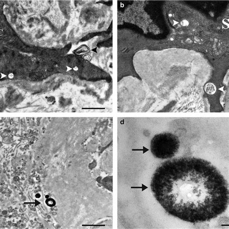 Transmission Electron Microscopy Micrographs Of Aortic Smooth Muscles Download Scientific