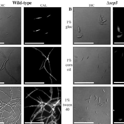 The ⌬ Sep3 Mutants Fail To Respond Morphologically To Lipids Wild Type Download Scientific