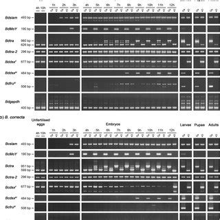 Expression Analysis Of Sex Determining Genes During The Early Stages Of