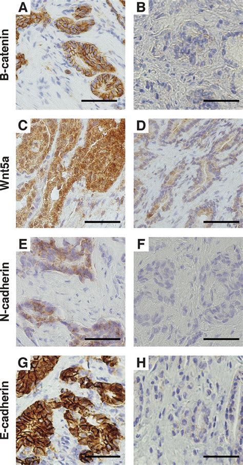 Immunohistochemical Staining Of The Immunohistochemistry Cohort A