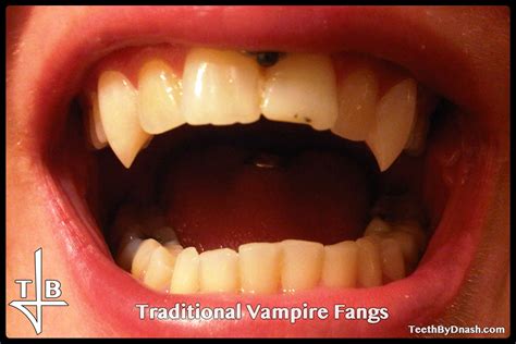 Traditional Vampire Teeth By Dnash