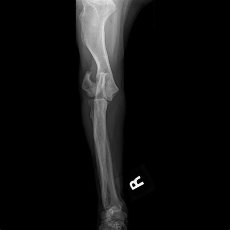 Orthopedic Diagnostics & Surgical Procedures - Skylos Sports Medicine