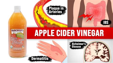 9 Unexpected Amazing Benefits Of Apple Cider Vinegar Acv Youtube