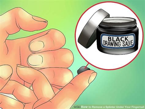 How To Remove A Splinter Under Your Fingernail Steps