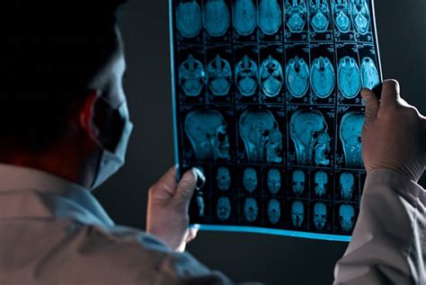 Understanding The Impact Of Traumatic Brain Injuries