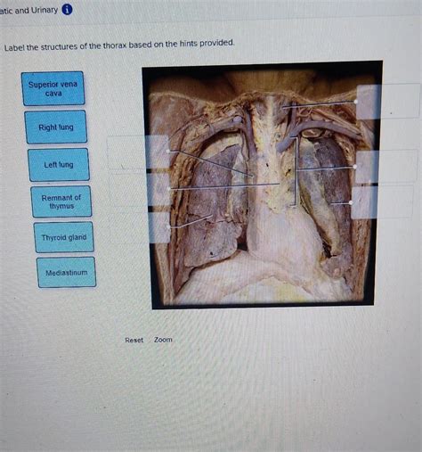 Solved Label The Structures Of The Thorax Based On The Hints