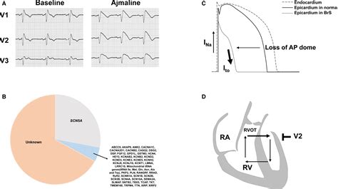 Brugada Syndrome Different Experimental Models And The Role Of Human