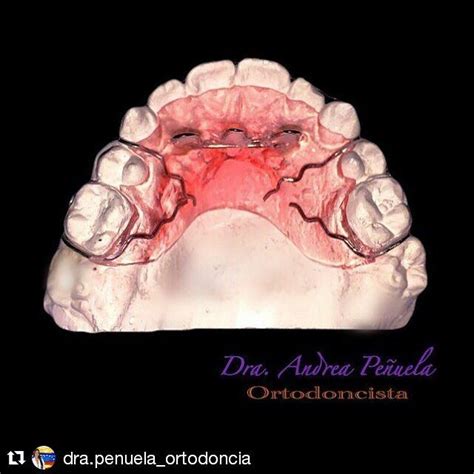 Prodental C A On Instagram Repost Dra Penuela Ortodoncia With