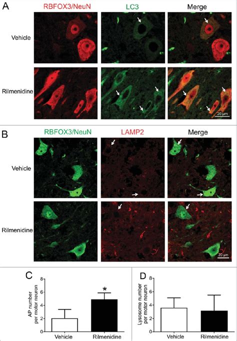 Rilmenidine treatment increases autophagosome number in spinal motor ...