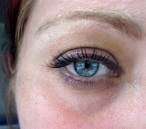 How To Clear Dark Circles Under The Eyes At Nona Carr Blog