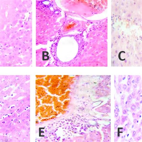 Photomicrograph Of Liver Sections Stained With H And E X400 Download Scientific Diagram