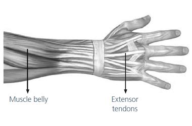 Advice and exercises following your extensor tendon repair - South Tees ...